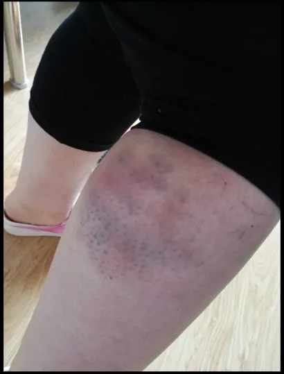 Foto: Privatni album