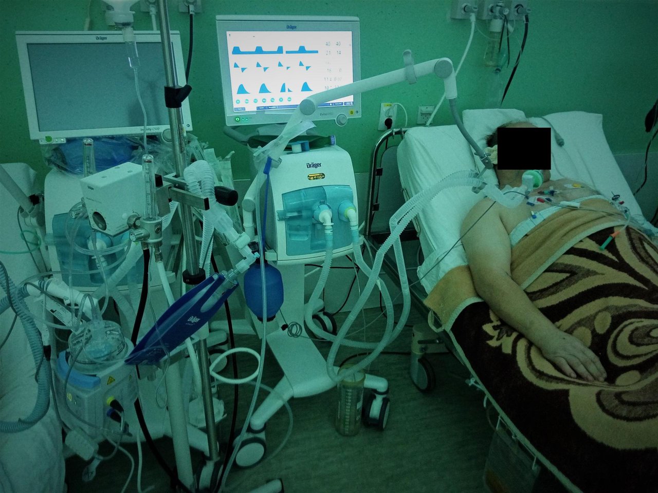 Fotografija: I danas je velik broj zaraženih pacijenata na respiratorima, njih čak devetero/Foto: Deni Marčinković
