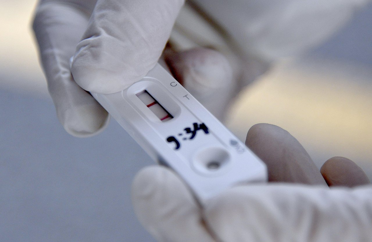 Fotografija: Brzi antigenski testovi koriste se s ciljem bržeg otkrivanja osoba zaraženih koronavirusom/Foto: Damir Krajac/CROPIX
